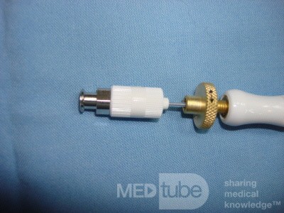 Large Gastric Varices (22 of 25)