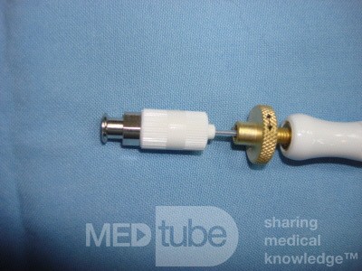Large Gastric Varices (22 of 25)