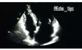 4. Echocardiography Case - What You See?