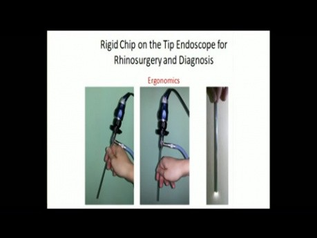 Rigid Chip on the Tip Endoscope for Rhinosurgery and Diagnosis