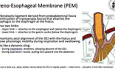 The Mechanism of the Anti-Reflux Barrier in Deep