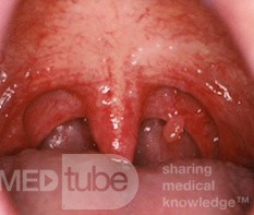 Pathologies of the Mouth