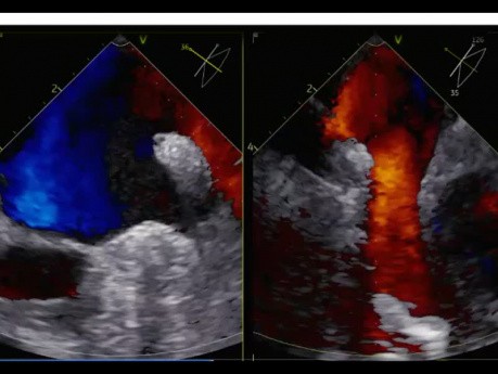 8. Echocardiography Case - What You See?