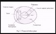Normal Biometry in Fetal Ultrasound Scans