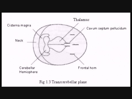 Normal Biometry in Fetal Ultrasound Scans