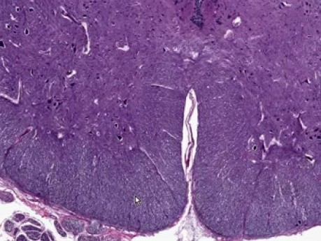 Spinal Cord - Histology