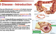 Diverticulosis, Volvulus & Rectal Prolapse