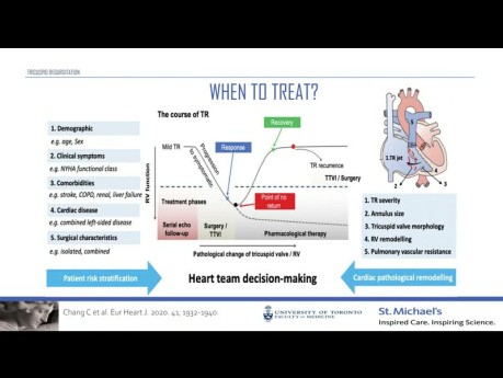 Importance of Tricuspid Regurgitation in Patients with Heart Failure