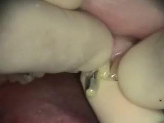 How to get a perfect smile in one visit?