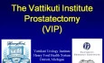 Prostatectomy For Prostate Cancer