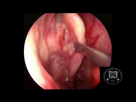 Nasal Anatomy