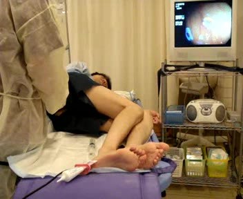 3 Minutes Total Colonoscopy - 5