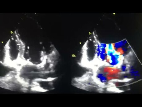 Can You Guess the Echocardiography Case?