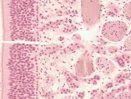 Nasal Cavity - Histology