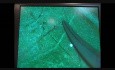 Microsurgery Tutorials. Lesson 2: The Basics. Taking Your Skills Further