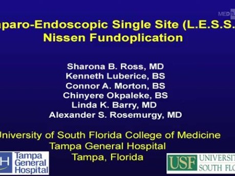 LESS Approach In Fundoplication Of The Nissen