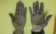 Raynaud's Phenomenon