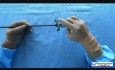 Laparoscopic PCOD Needle
