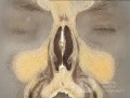 Coronal Anatomy of the Nose and Paranasal Sinuses: Slice 1