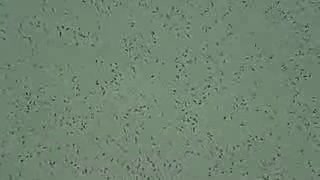 Human sperm
