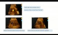 Restrictive Foramen Ovale in Fetal Period and Post Natal Process