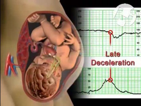 The Fetal Brain-Fetal Heart Relationship