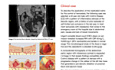 TachoSil® Clinical Cases in General Surgery