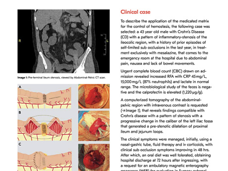 TachoSil® Clinical Cases in General Surgery