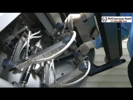Da Vinci Robotic Hysterectomy