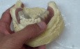Removable Denture Clasp Repair Part 3 - Denture On Cast