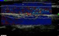 Motion Analysis 