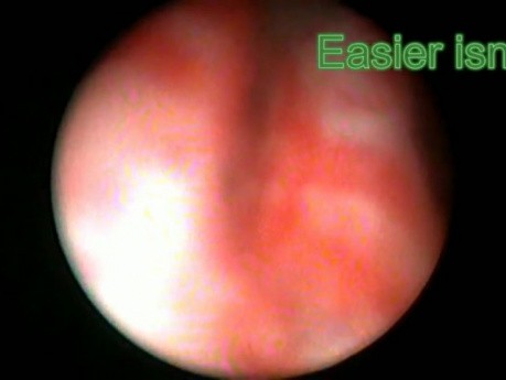 Ureteroscopy - Part 1
