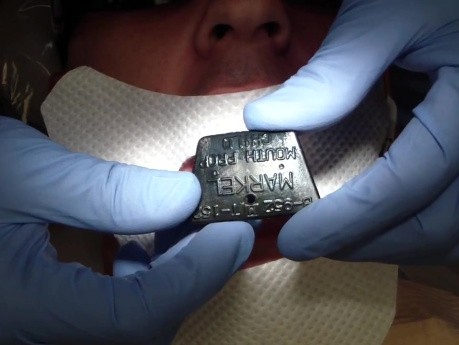 Mouth Prop/Bite Block