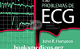 150 Problems of ECG