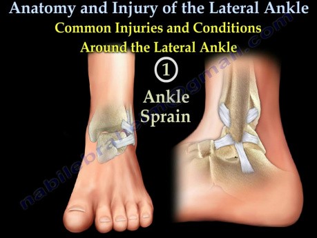 Anatomy And Injuries Of The Lateral Ankle 