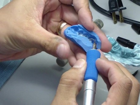 Lab Processed Bridge Fabrication - Radica - Light Cured Composite