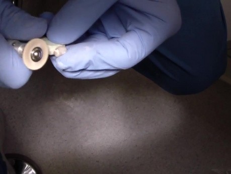 Chairside Porcelain Crown Polishing