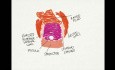 Repair of Recurrent Traumatic Rectovaginal Fistula