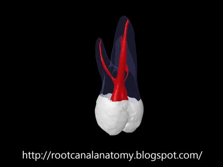 Maxillary First Molar
