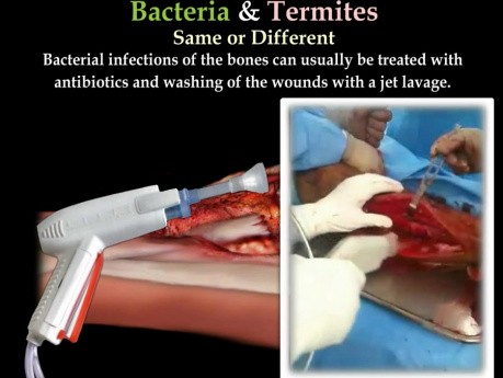 Termites & Bacteria Infection - Video Lecture