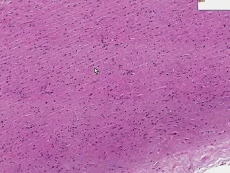 Aorta - Histology