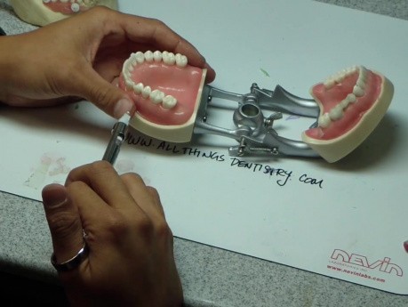 Palatal Anesthesia - Answer To Question