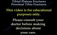 Tibial Plateau Fractures Proximal Tibia Fractures 