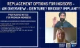 Replacement Options for Incisors - An Overview - Denture_ Bridge_ Implant