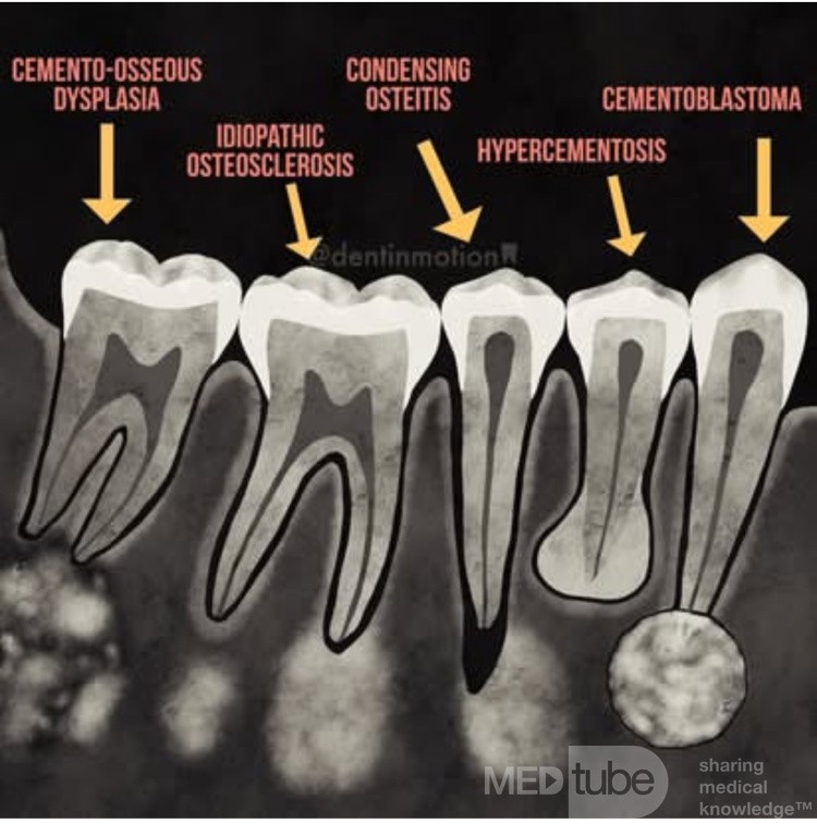 Developmental Anomalies in Dentistry