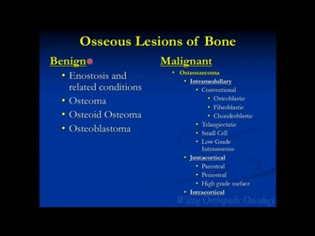 Orthopedic Oncology Course - Benign Bone Forming Tumors (Osteoblastoma, Osteoid Osteoma)- Lecture 3 