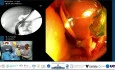 When One Scope Reveals Three Diagnoses