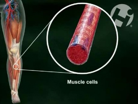 Compartment Syndrome