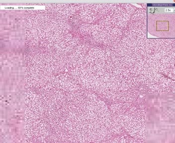 Liver - Fatty Change 3