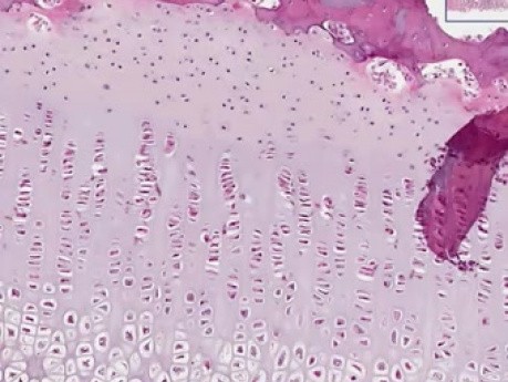 Endochondral Ossification - Histology